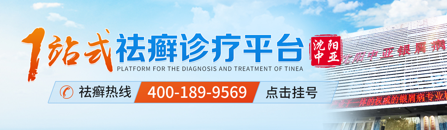 沈阳中亚银屑病研究所